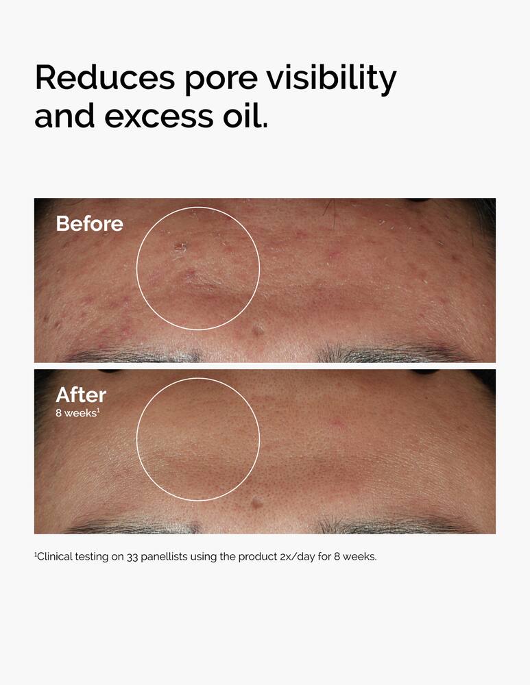 rinascente The Ordinary Niacinamide 10% + Zinc 1% Serum