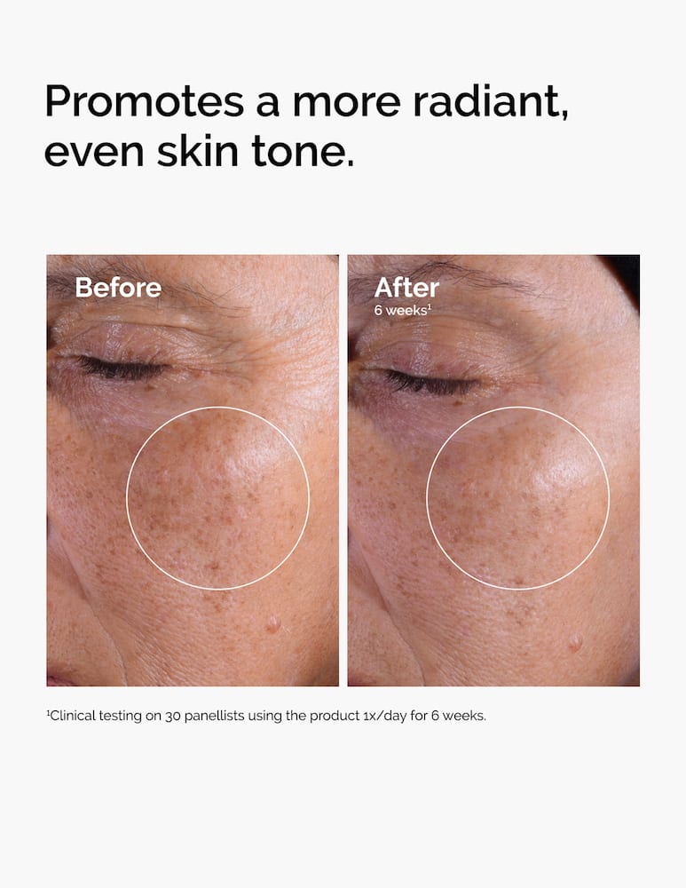 The Ordinary Glycolic Acid 7% Exfoliating Toner - immagine 3 The Ordinary Glycolic Acid 7% Exfoliating Toner - immagine 3