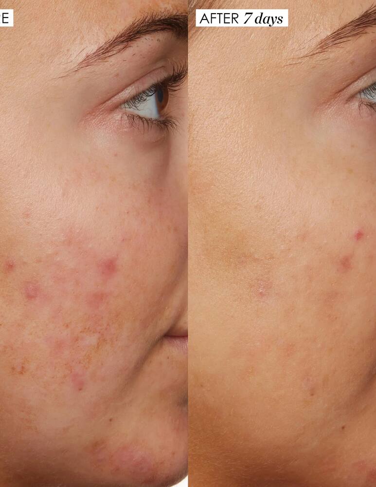 rinascente Sunday Riley B3 Nice 10% Niacinamide Serum