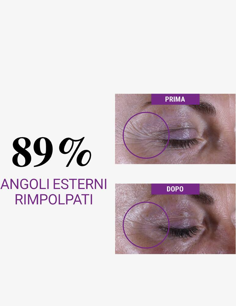 rinascente Kiehl's Super Multi-Corrective Eye Zone Treatment