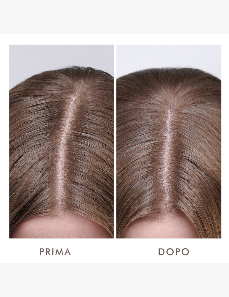 Moroccanoil Dry Scalp Treatment DRY - picture 6 Moroccanoil Dry Scalp Treatment DRY - picture 6