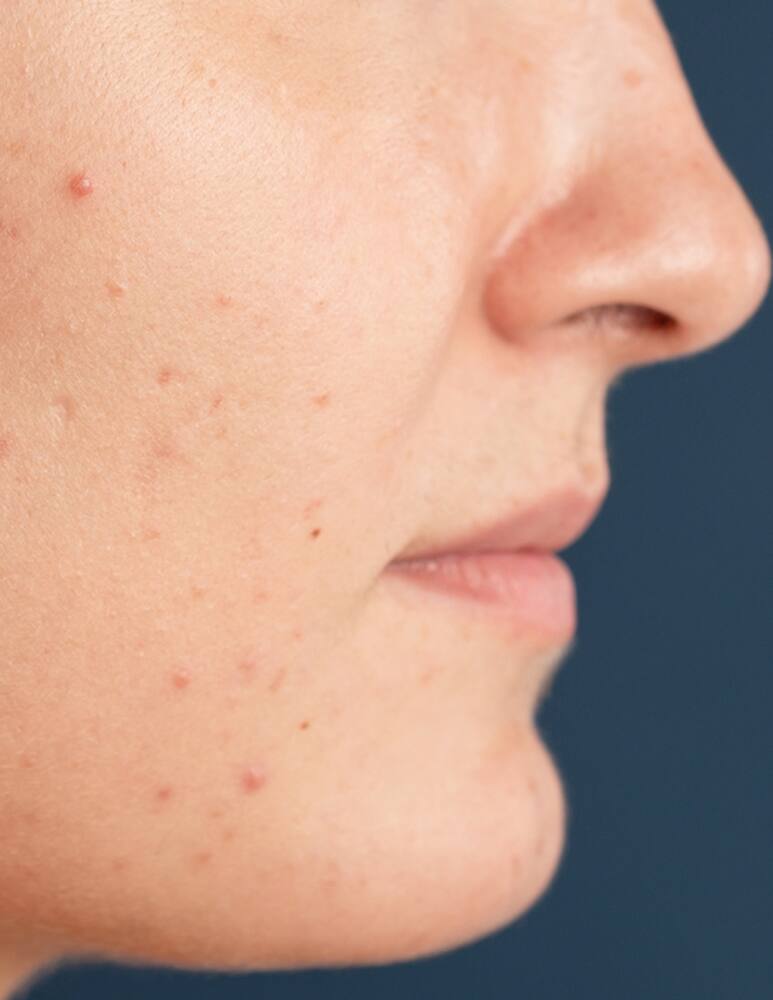 rinascente Freshly Cosmetics Blue Radiance Enzymatic Serum