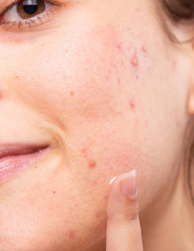 rinascente Freshly Cosmetics Azelaic Radiance Face Treatment