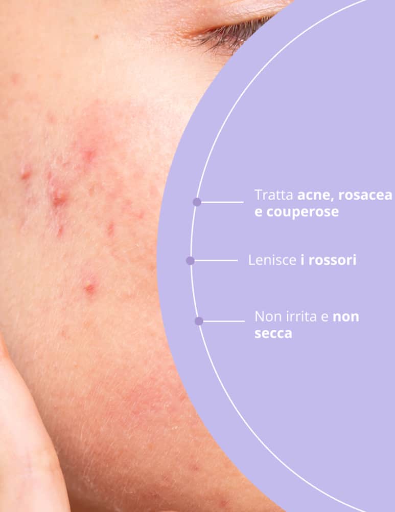 Freshly Cosmetics Azelaic Radiance Face Treatment - picture 4 Freshly Cosmetics Azelaic Radiance Face Treatment - picture 4