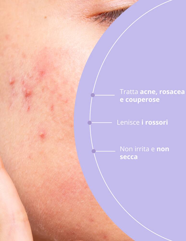 rinascente Freshly Cosmetics Azelaic Radiance Face Treatment