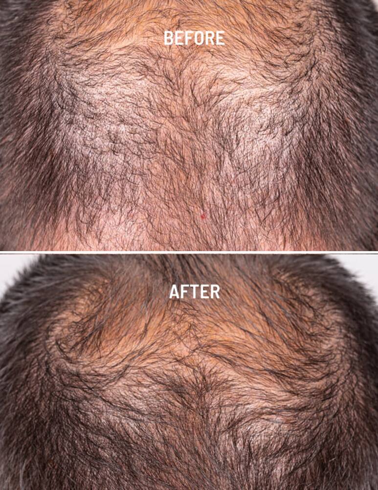 rinascente Freshly Cosmetics Hair Growth & Density Treatment